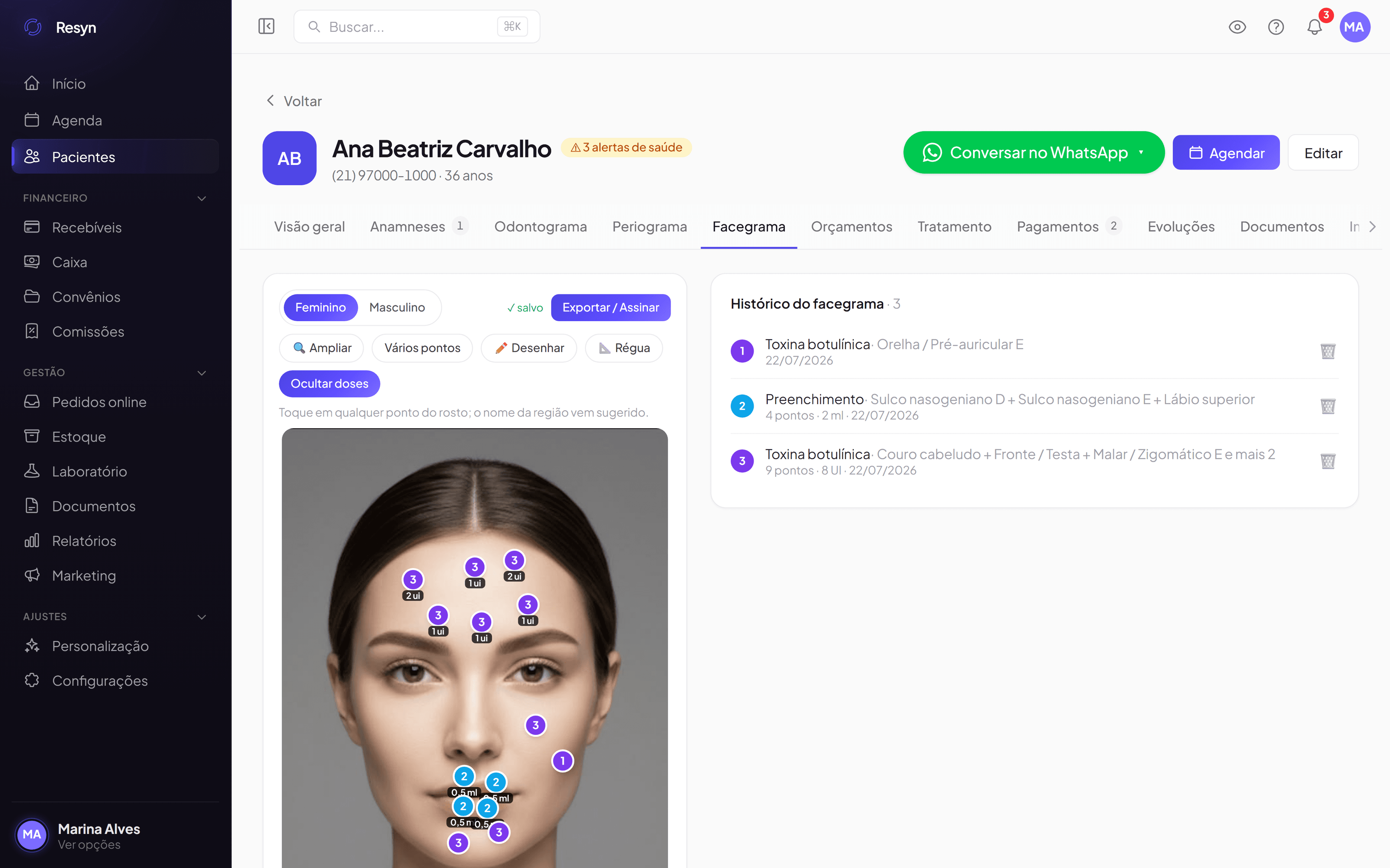 Facegrama: dose por ponto no mapa do rosto