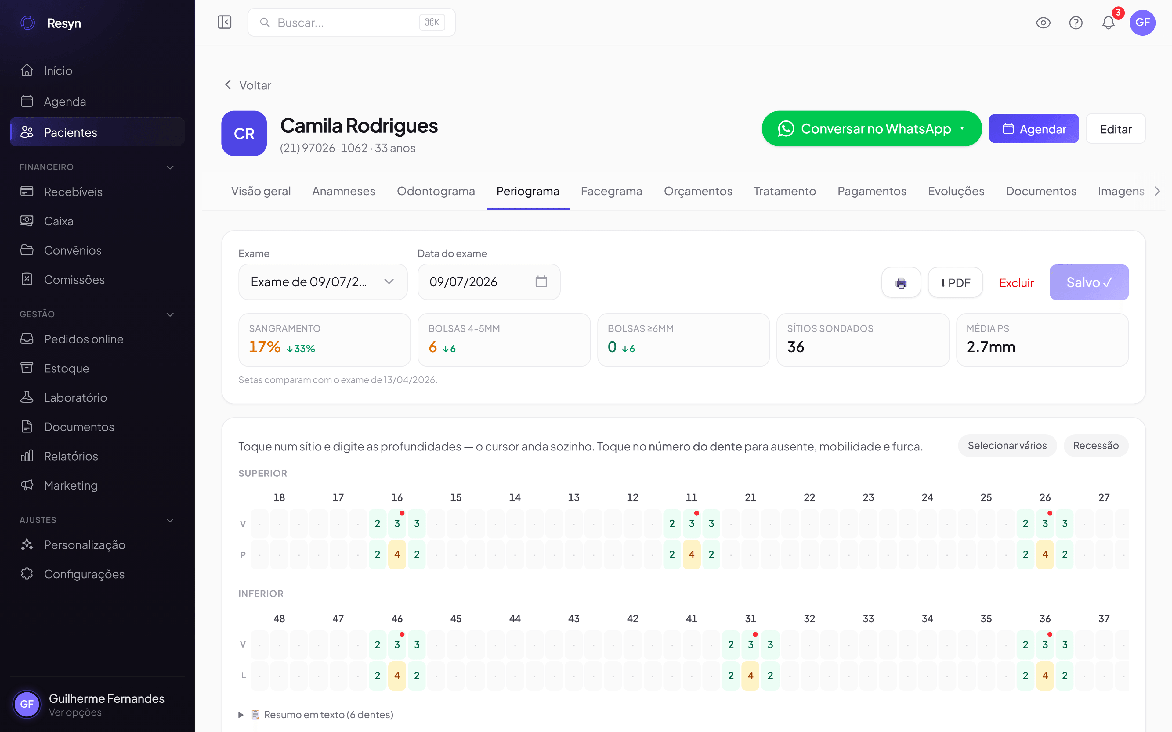 Periograma da Resyn
