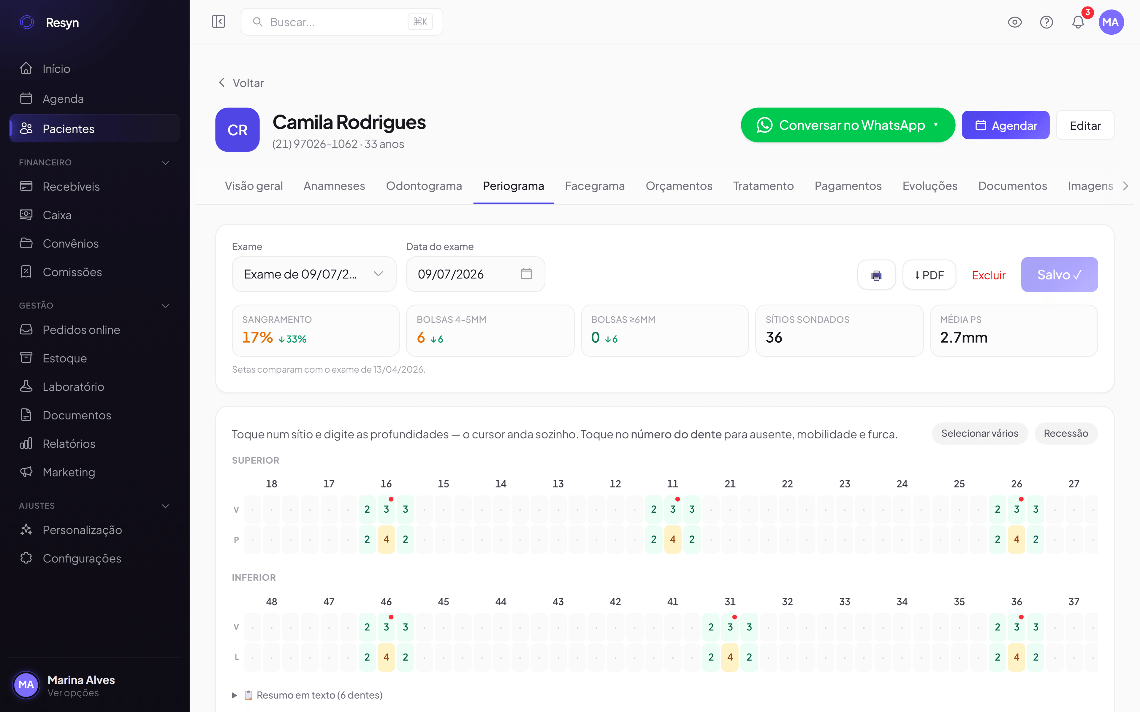 Periograma da Resyn