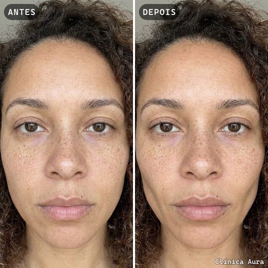 Antes e depois exportado no formato Feed 1:1
