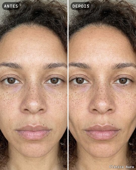 Antes e depois exportado no formato Retrato 4:5