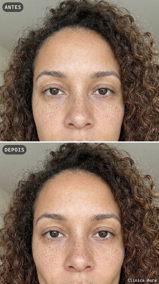 Antes e depois exportado no formato Stories 9:16